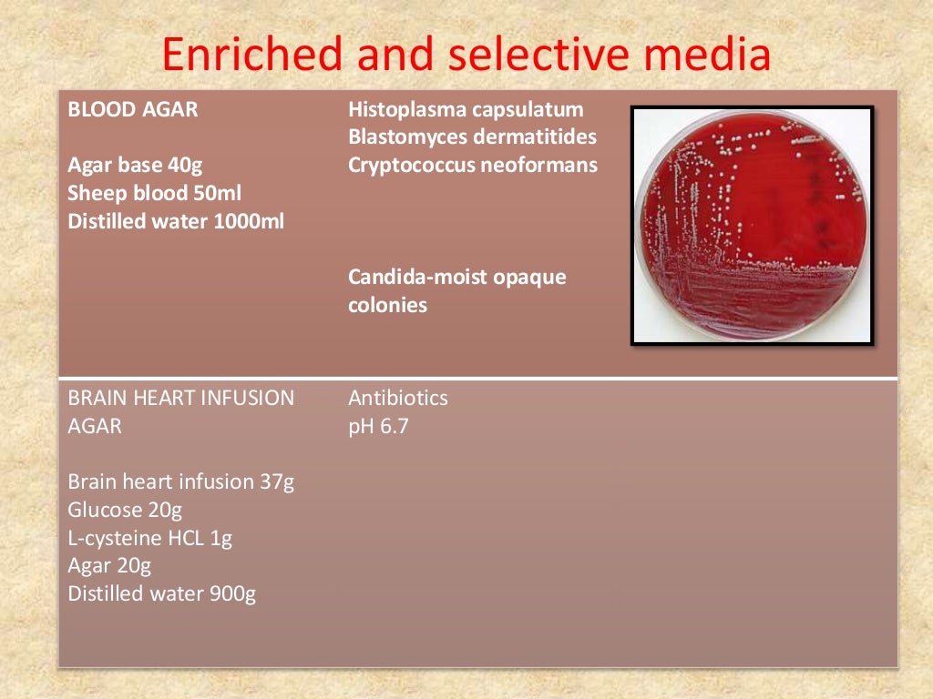 Lab diagnosis of fungal infections, Dr Naveen Reddy