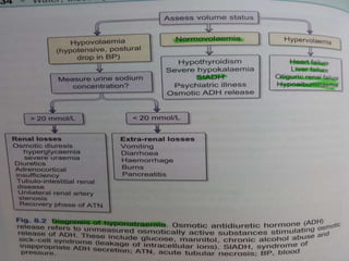 Diagnosis of Hyponatremia