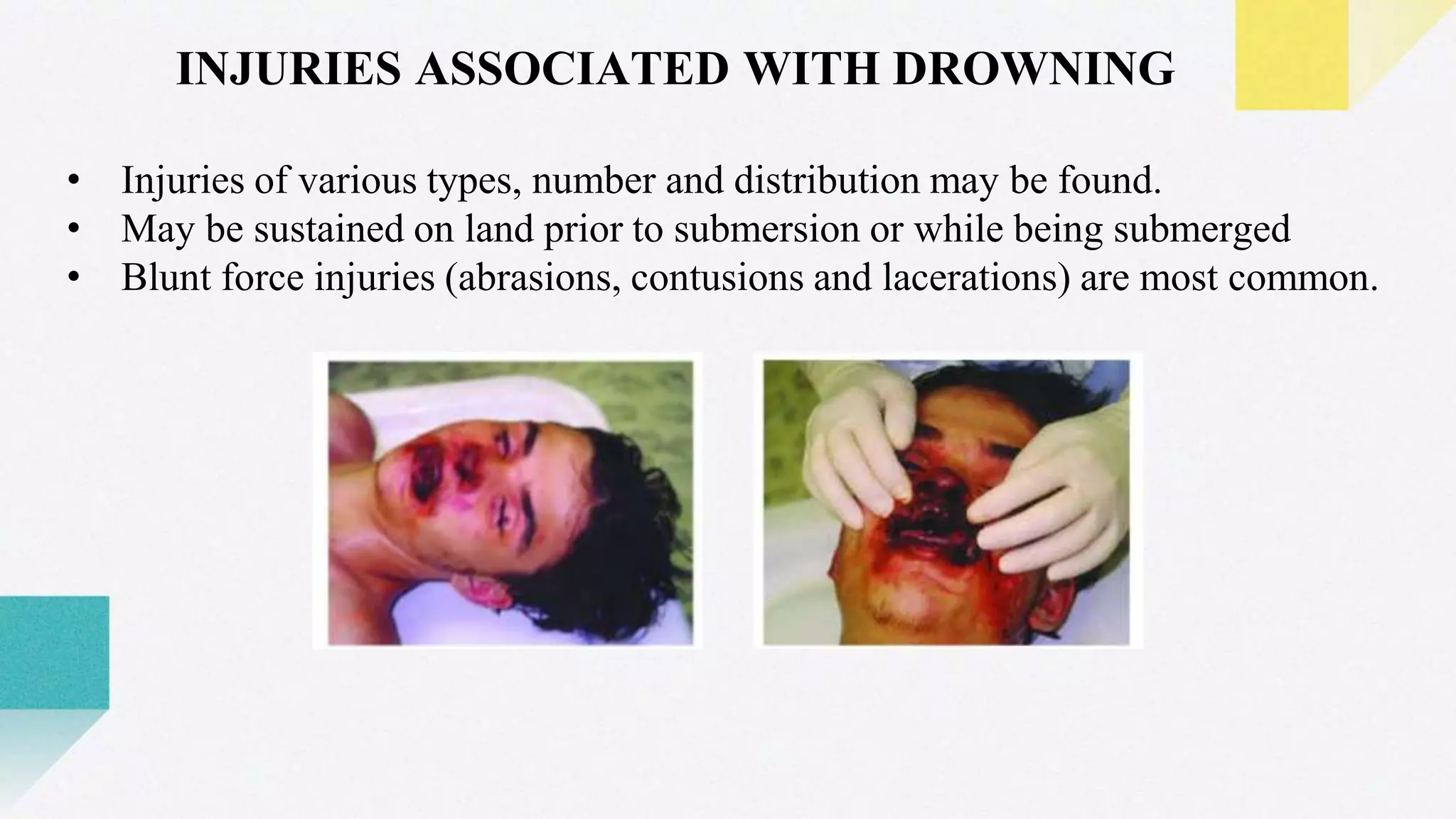 DIAGNOSIS OF INJURIES ASSOCIATED WITH DROWNING_ANEETTA JOJI_FORENSIC ...