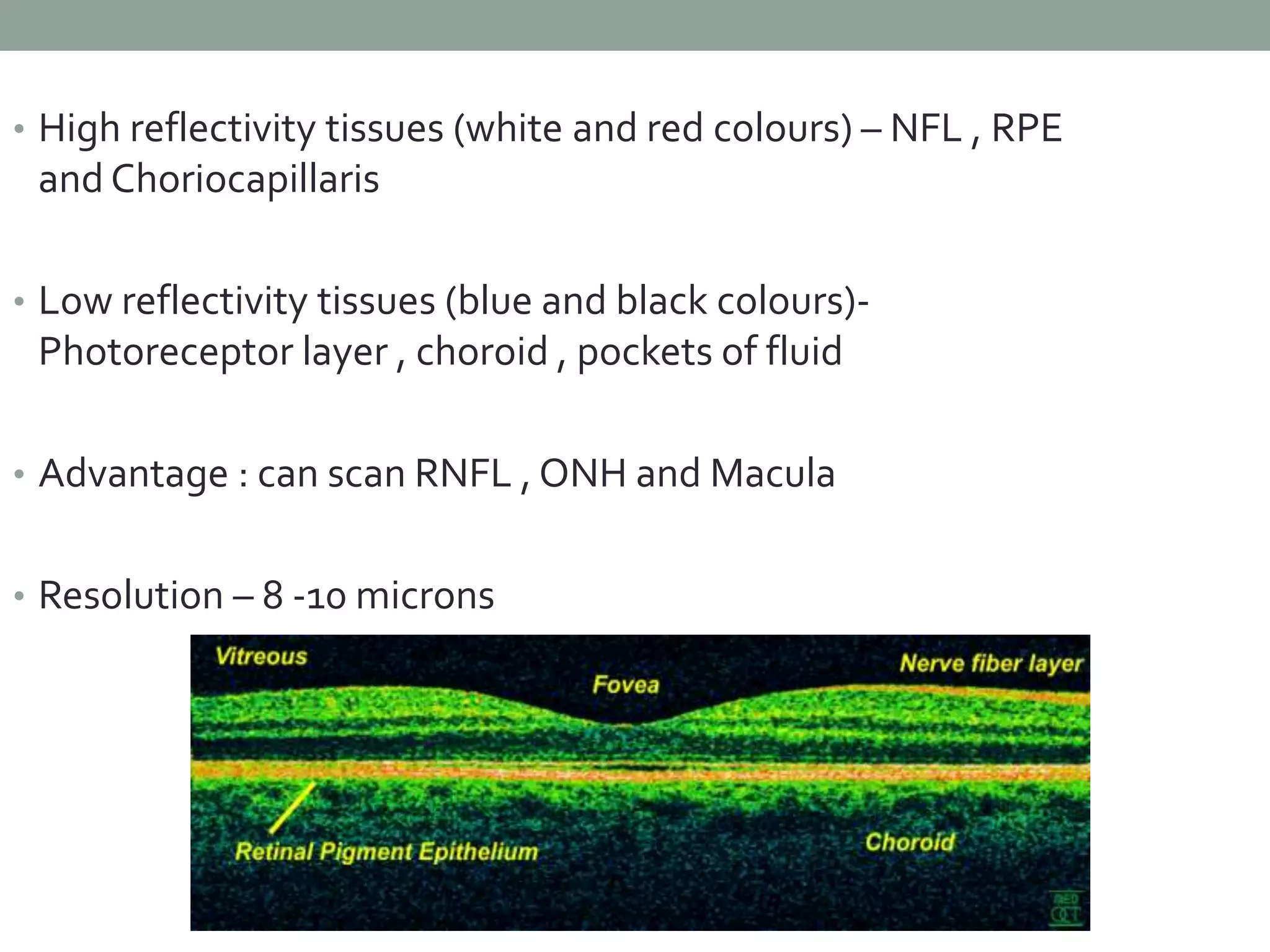 Pre Rpe Fluid Diagnosis of pre perimetric glaucoma | PPTX