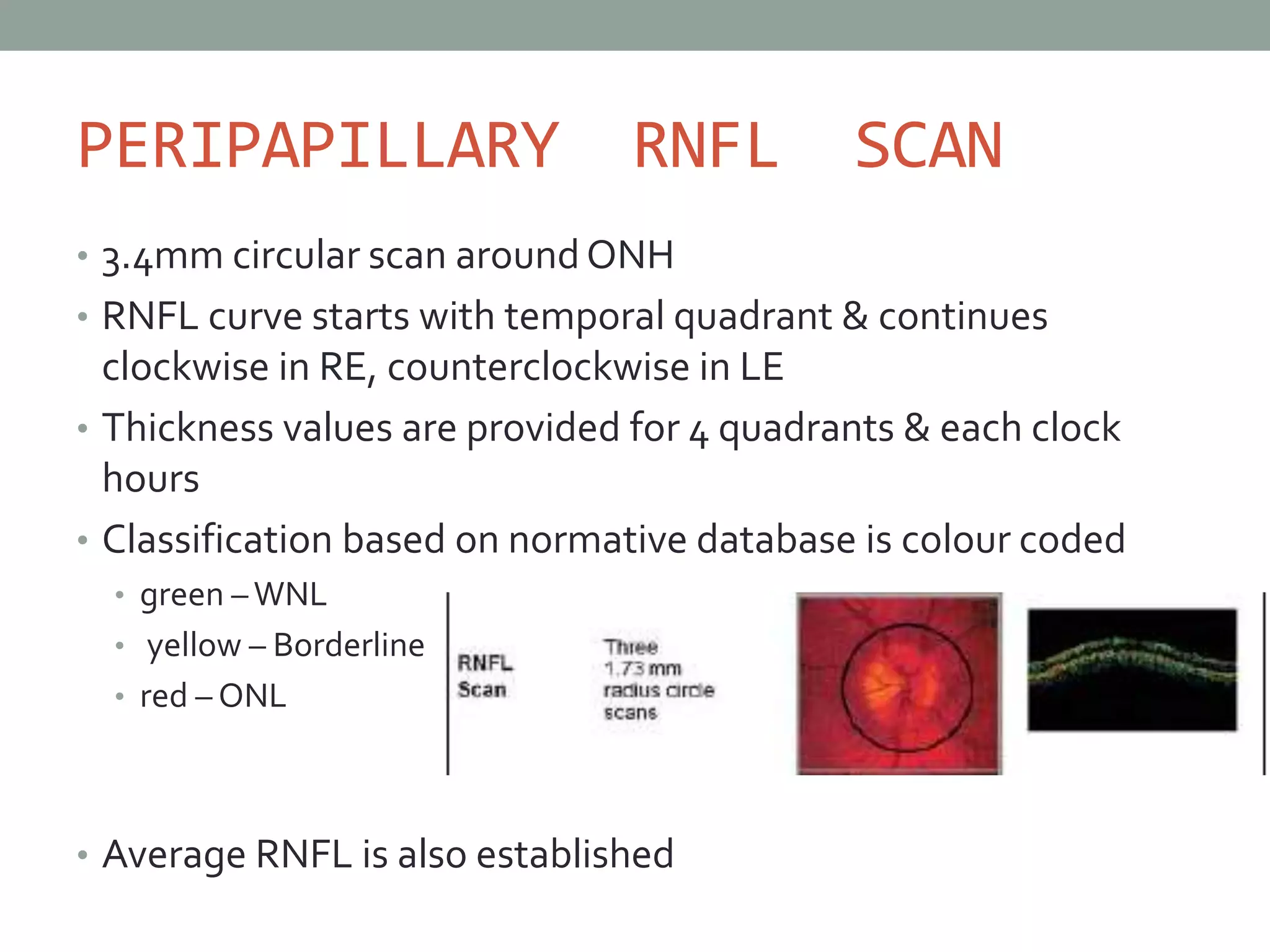 Diagnosis Of Pre Perimetric Glaucoma PPTX