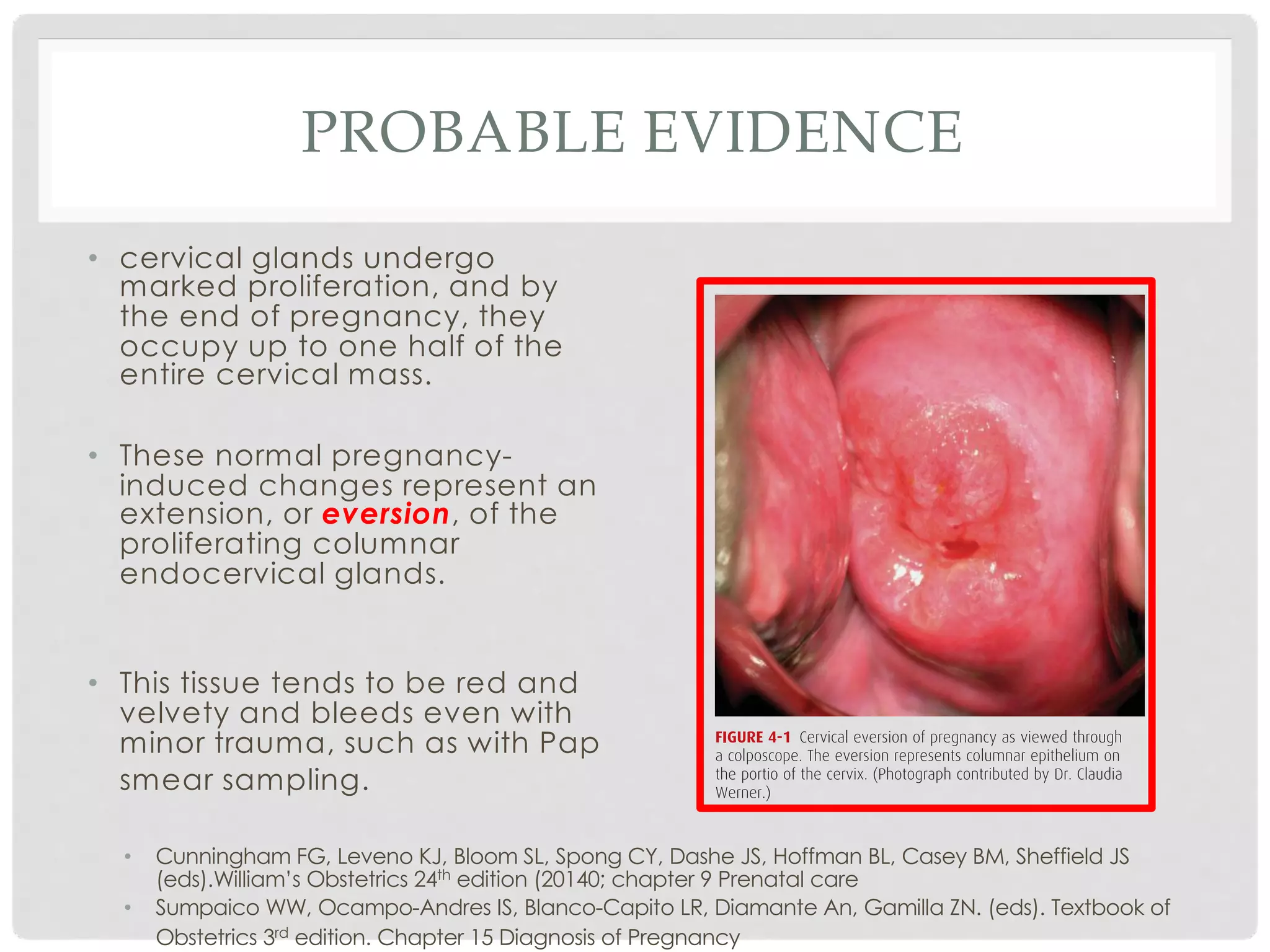 Diagnosis of pregnancy | PDF