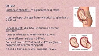 Enciform Diagnosis of pregnancy | PPTX