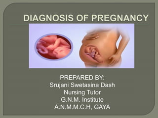 Diagnosis of pregnancy.pptx