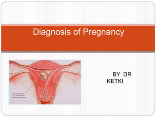 BY DR
KETKI
Diagnosis of Pregnancy
y
 