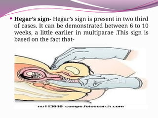 DIAGNOSIS OF PREGNANCY PPT IN ALL TRIMESTER | PPTX