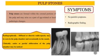 Pathologic Stones DIAGNOSIS OF PULP.pptx