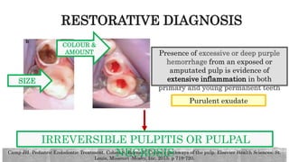 Pulp Bleeding Color DIAGNOSIS OF PULP.pptx