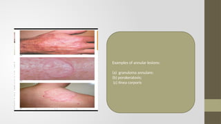 diagnosis of skin diseases description.pptx