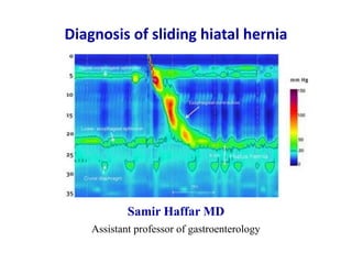 Diagnosis of sliding hiatal hernia
Samir Haffar MD
Assistant professor of gastroenterology
 