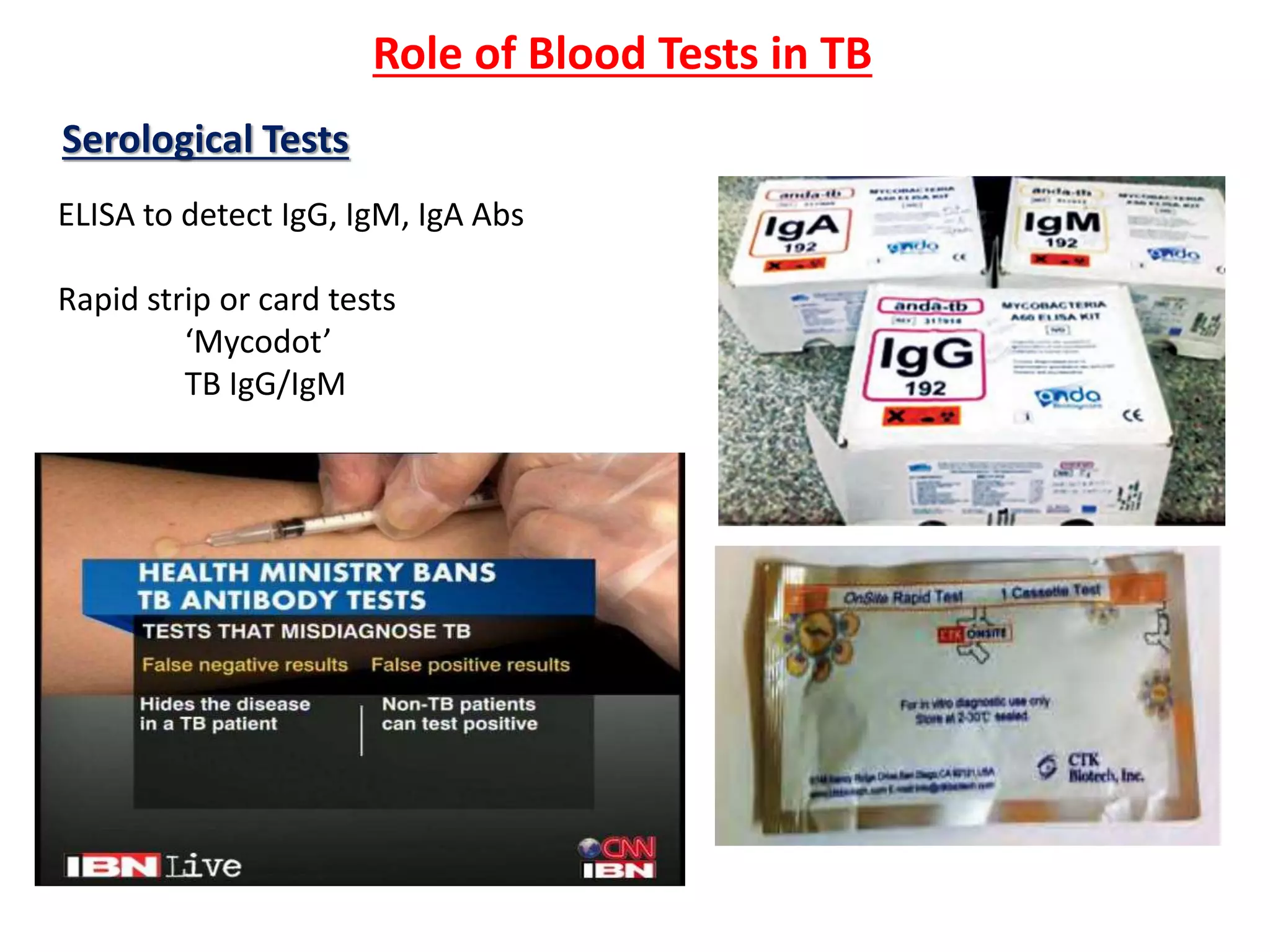 Diagnosis of Tuberculosis | PPTX