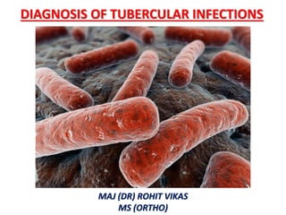 DIAGNOSIS OF TUBERCULAR INFECTIONS
MAJ (DR) ROHIT VIKAS
MS (ORTHO)
 
