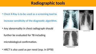 National tuberculosis elimination program guidelines for diagnosis of ...