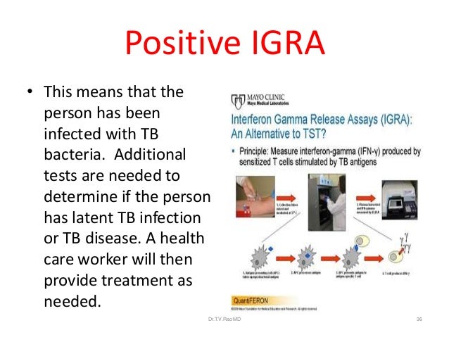 Diagnosis of Tuberculosis an Update