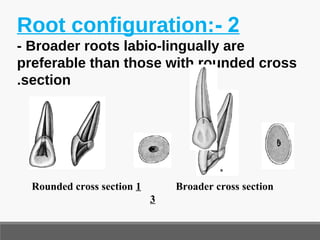 Root Configuration Diagnosis related to fixed prosthodontics | PPT