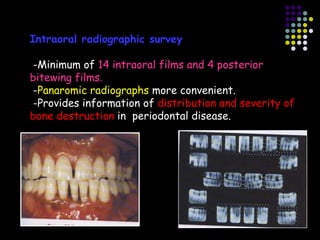 diagnosis seminarvin.ppt