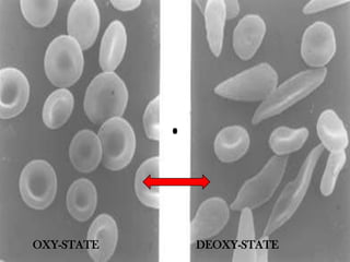 OXY-STATE DEOXY-STATE
 