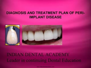 DIAGNOSIS AND TREATMENT PLAN OF PERI-
IMPLANT DISEASE
INDIAN DENTAL ACADEMY
Leader in continuing Dental Education
www.indiandentalacademy.com
 