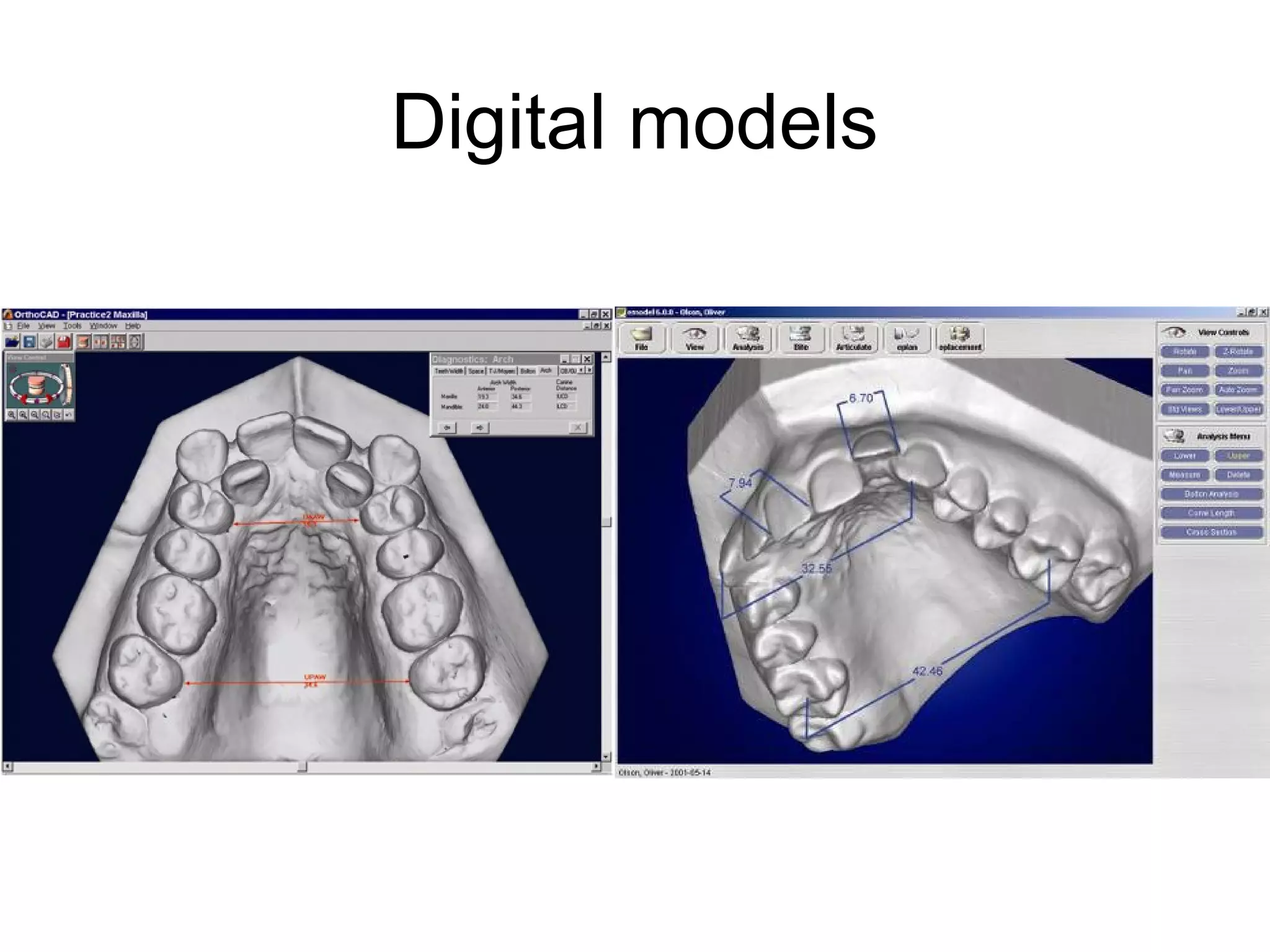 Digital models