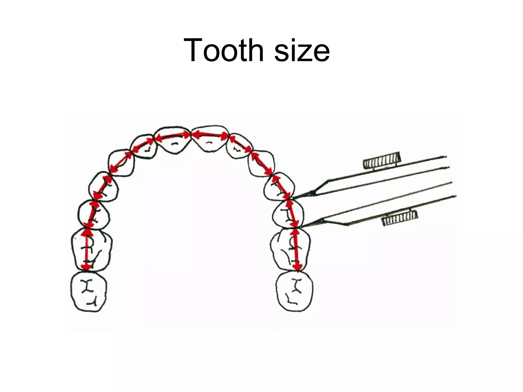 Tooth size