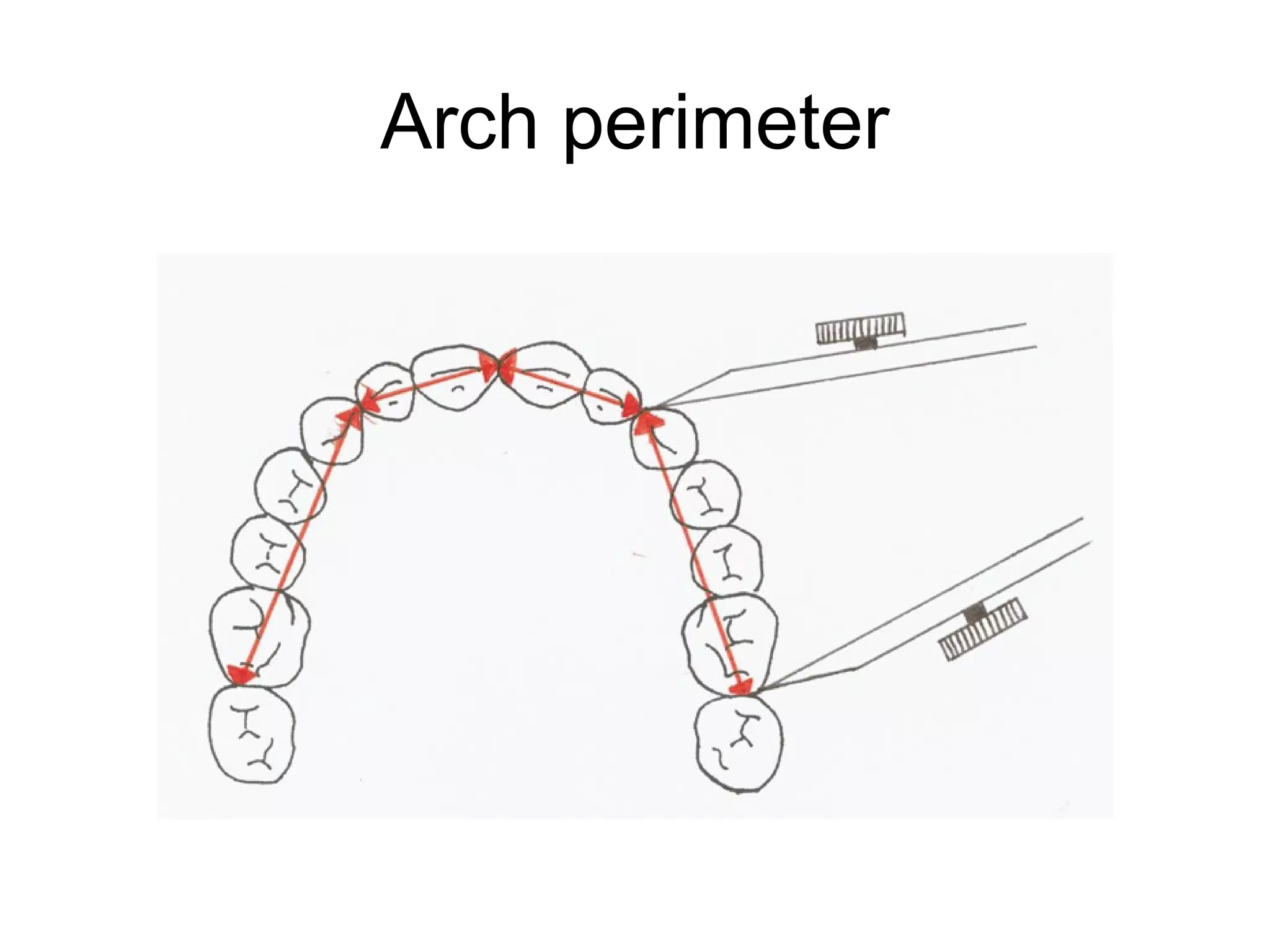 Arch perimeter