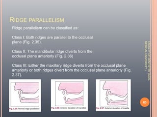 Diagnosis & Treatment Planning In Complete denture By Dr Anmol Asghar ...
