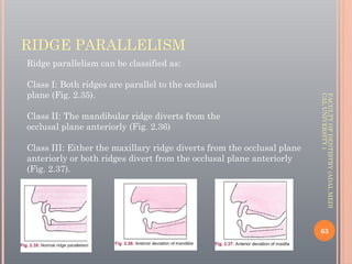 Two Ridges Running Parallel Diagnosis & Treatment Planning for Complete Denture By Dr Anmol Asghar ...