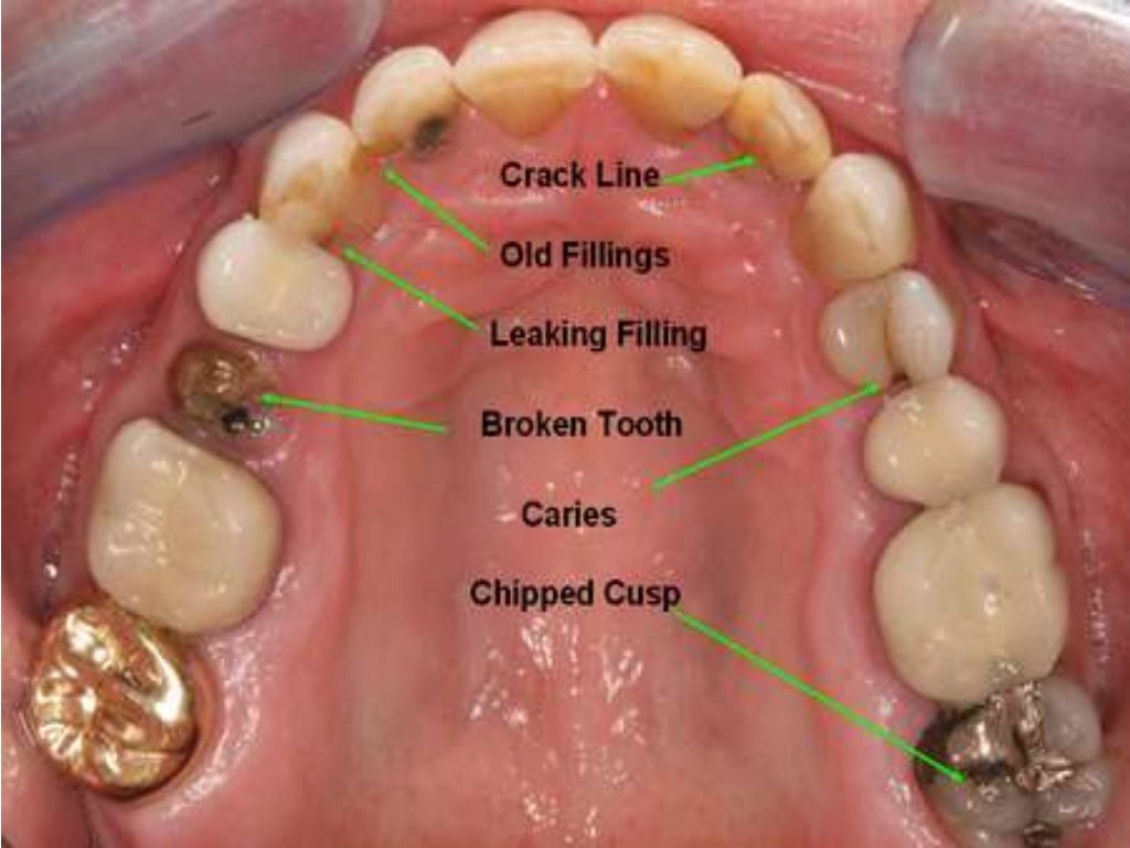Diagnosis &treatment planning in conservative dentistry dr arsalan