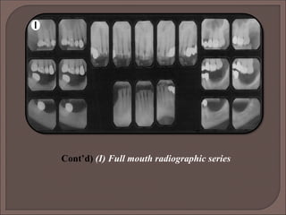 Diagnosis & Treatment Planning in fixed partial denture | PPT