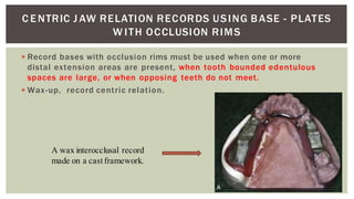 Occlusal Record Rpd diagnosis & treatment planning in RPD PS.pptx