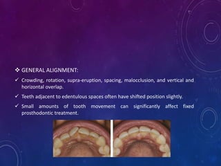 Diagnosis & Treatment Planning in FPD | PPTX