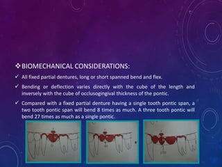 BIOMECHANICAL CONSIDERATIONS:
 All fixed partial dentures, long or short spanned bend and flex.
 Bending or deflection ...