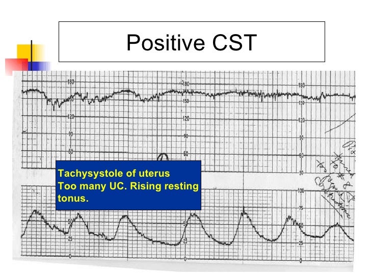 Diagnositcs day 2 review