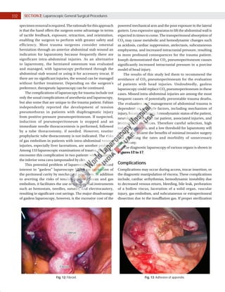 332 SECTION 2: Laparoscopic General Surgical Procedures
specimenremovalisrequired.Therationaleforthisapproach
is that the hand offers the surgeon some advantage in terms
of tactile feedback, exposure, retraction, and orientation,
enabling the surgeon to perform with greater safety and
efficiency. Most trauma surgeons consider omental
herniation through an anterior abdominal stab wound an
indication for laparotomy because frequently there are
significant intra-abdominal injuries. As an alternative
to laparotomy, the herniated omentum was evaluated
and managed, with laparoscopy performed through the
abdominal stab wound or using it for accessory trocar. If
there are no significant injuries, the wound can be managed
without further treatment. Depending on the surgeon’s
preference, therapeutic laparoscopy can be continued.
The complications of laparoscopy for trauma include not
only the usual complications of anesthesia and laparoscopy,
but also some that are unique to the trauma patient. Fabian
independently reported the development of tension
pneumothorax in patients with diaphragmatic injury
from positive-pressure pneumoperitoneum. If suspected,
induction of pneumoperitoneum is stopped and an
immediate needle thoracocentesis is performed, followed
by a tube thoracostomy, if needed. However, routine
prophylactic tube thoracostomy is not indicated. The risks
of gas embolism in patients with intra-abdominal venous
injuries, especially liver lacerations, are another problem.
Among 133 laparoscopic examinations of trauma, Smith did
encounter this complication in two patients with injuries of
the inferior vena cava tamponaded by clot.
This potential problem of laparoscopy has stimulated
interest in ‘‘gasless’’ laparoscopy based on expansion of
the peritoneal cavity by mechanical retractors. In addition
to averting the risks of tension pneumothorax and gas
embolism, it facilitates the use of conventional instruments
such as hemostats, needles, sutures, and electrocautery,
resulting in significant cost savings. The major disadvantage
of gasless laparoscopy, however, is the excessive cost of the
powered mechanical arm and the poor exposure in the lateral
gutters. Less expensive apparatus to lift the abdominal wall is
expected in times to come. The transperitoneal absorption of
CO2 may cause metabolic and hemodynamic changes such
as acidosis, cardiac suppression, atelectasis, subcutaneous
emphysema, and increased intracranial pressure, resulting
in more profound consequences for the trauma patient.
Joseph demonstrated that CO2 pneumoperitoneum causes
significantly increased intracranial pressure in a porcine
model of head injury.
The results of this study led them to recommend the
avoidance of CO2 pneumoperitoneum for the evaluation
of patients with head injuries. Undoubtedly, gasless
laparoscopy could replace CO2 pneumoperitoneum in these
cases. Missed intra-abdominal injuries are among the most
frequent causes of potentially preventable trauma deaths.
The evaluation and management of abdominal trauma is
dependent on multiple factors, including mechanism of
injury, location of injury, hemodynamic status of the patient,
neurological status of the patient, associated injuries, and
institutional resources. Therefore careful selection, high
index of suspicion, and a low threshold for laparotomy will
provide the patient the benefits of minimal invasive surgery
and reducing the rates and morbidity of unnecessary
laparotomy.
The diagnostic laparoscopy of various organs is shown in
Figures 12 to 17.
Complications
Complications may occur during access, trocar insertion, or
the diagnostic manipulation of viscera. These complications
include, cardiac arrhythmias, hemodynamic instability due
to decreased venous return, bleeding, bile leak, perforation
of a hollow viscus, laceration of a solid organ, vascular
injury, gas embolism, and subcutaneous or extraperitoneal
dissection due to the insufflation gas. If proper sterilization
Fig. 12: Fibroid. Fig. 13: Adhesion of appendix.
 