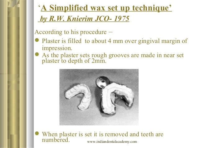 a model trimmed will be maxillary Diagnostic technique setup. xeroradiography,clarks opg, a model trimmed will be maxillary Diagnostic technique setup. xeroradiography,clarks opg,