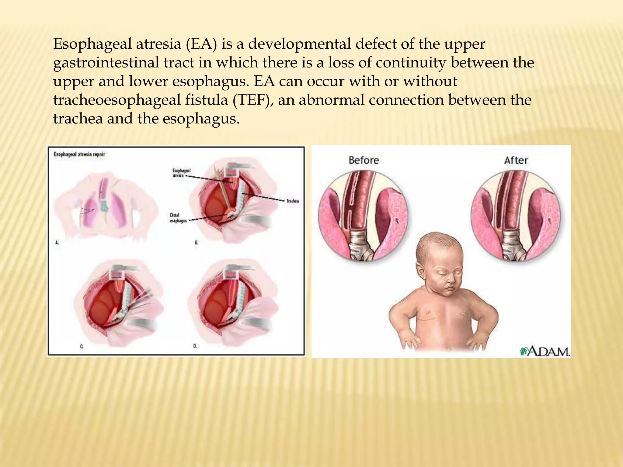     Encourage verbalization of fears and concerns. Explain further that: