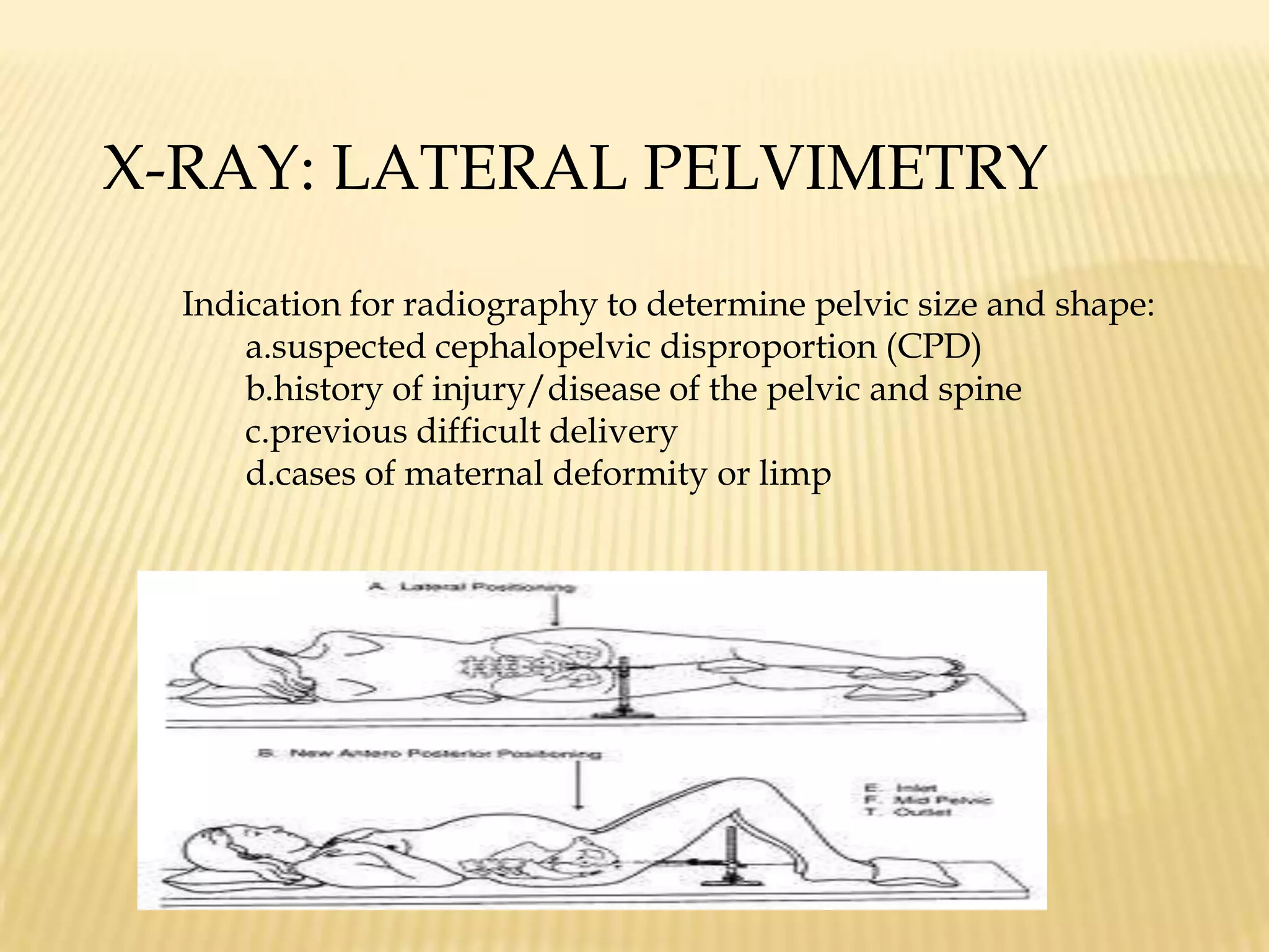 Procedure is non invasive and safe for mother and fetus.