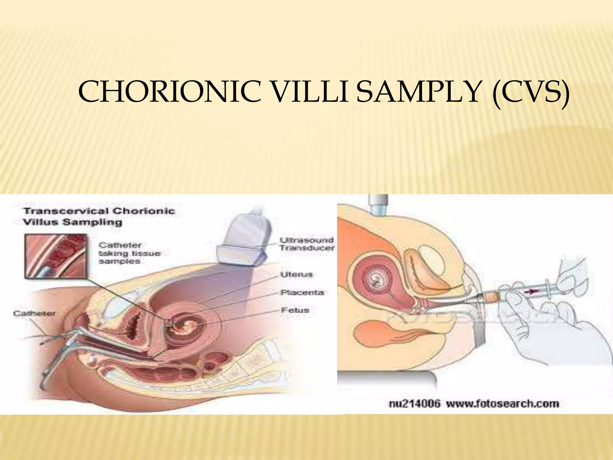 Confinement is not needed