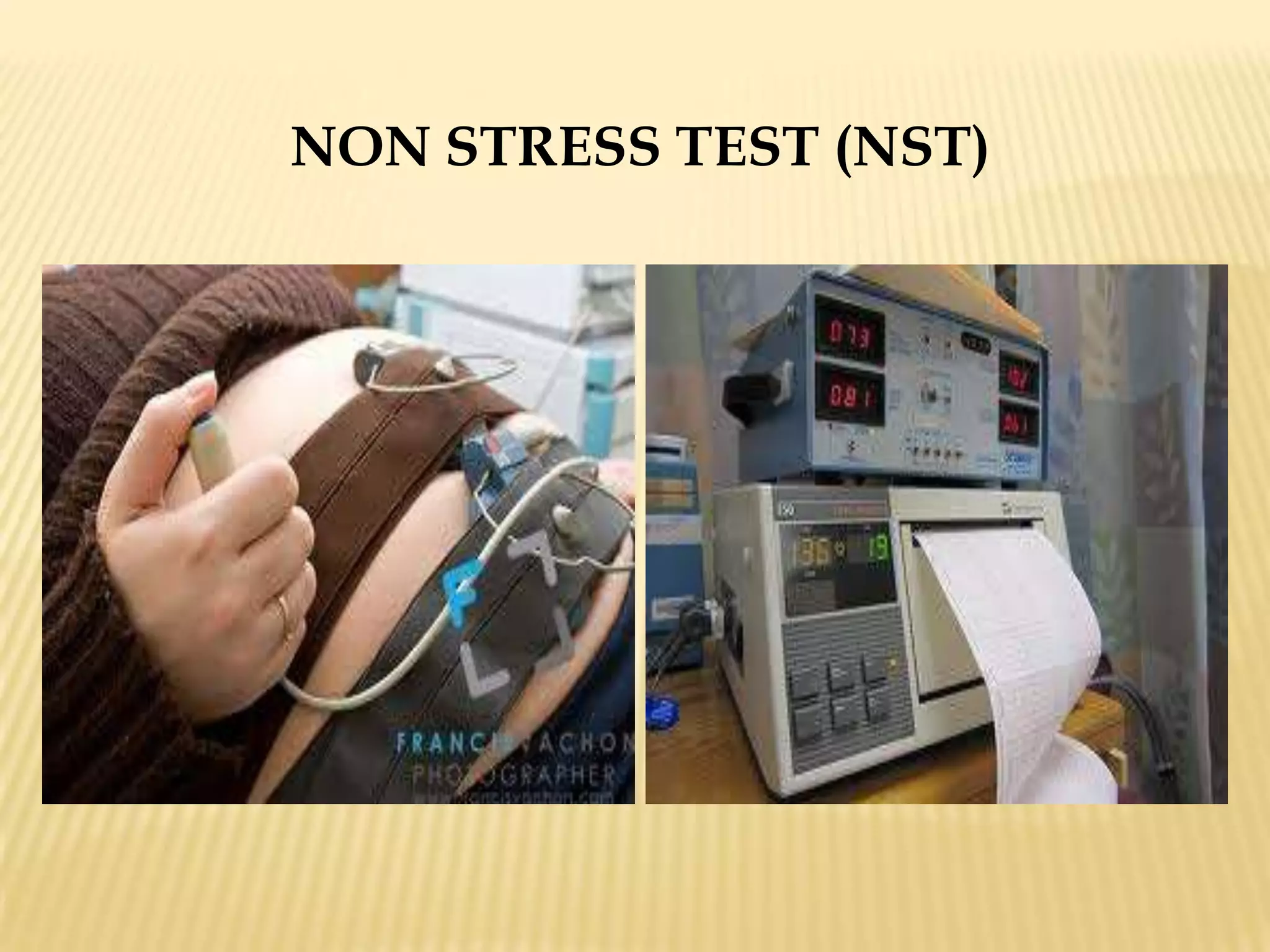  The doctor will check the fetal heart rate.