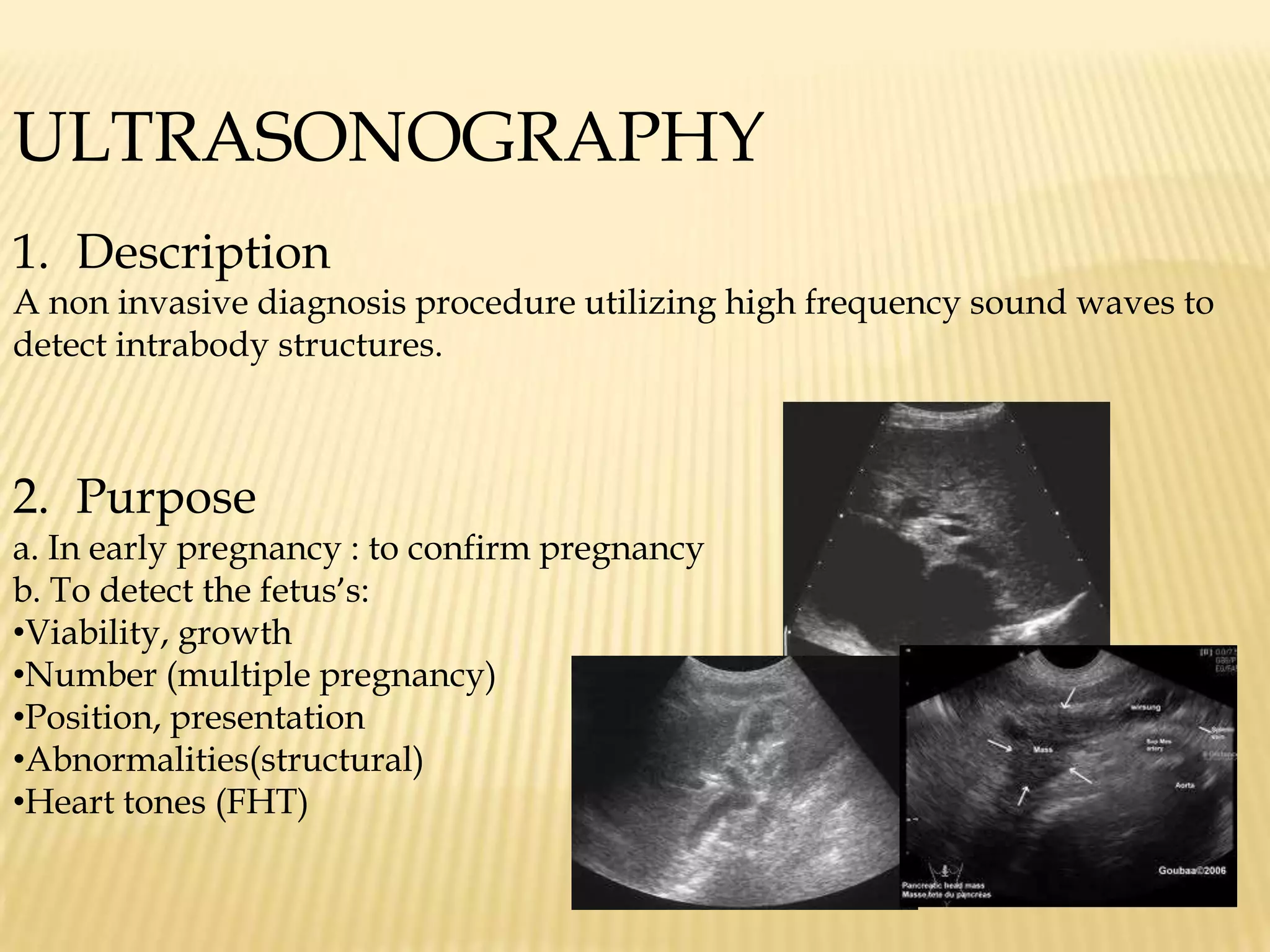 ULTRASONOGRAPHY Description A non invasive diagnosis procedure utilizing high frequency sound waves to detect intrabody structures.Purposea. In early pregnancy : to confirm pregnancyb. To detect the fetus’s:Viability, growth