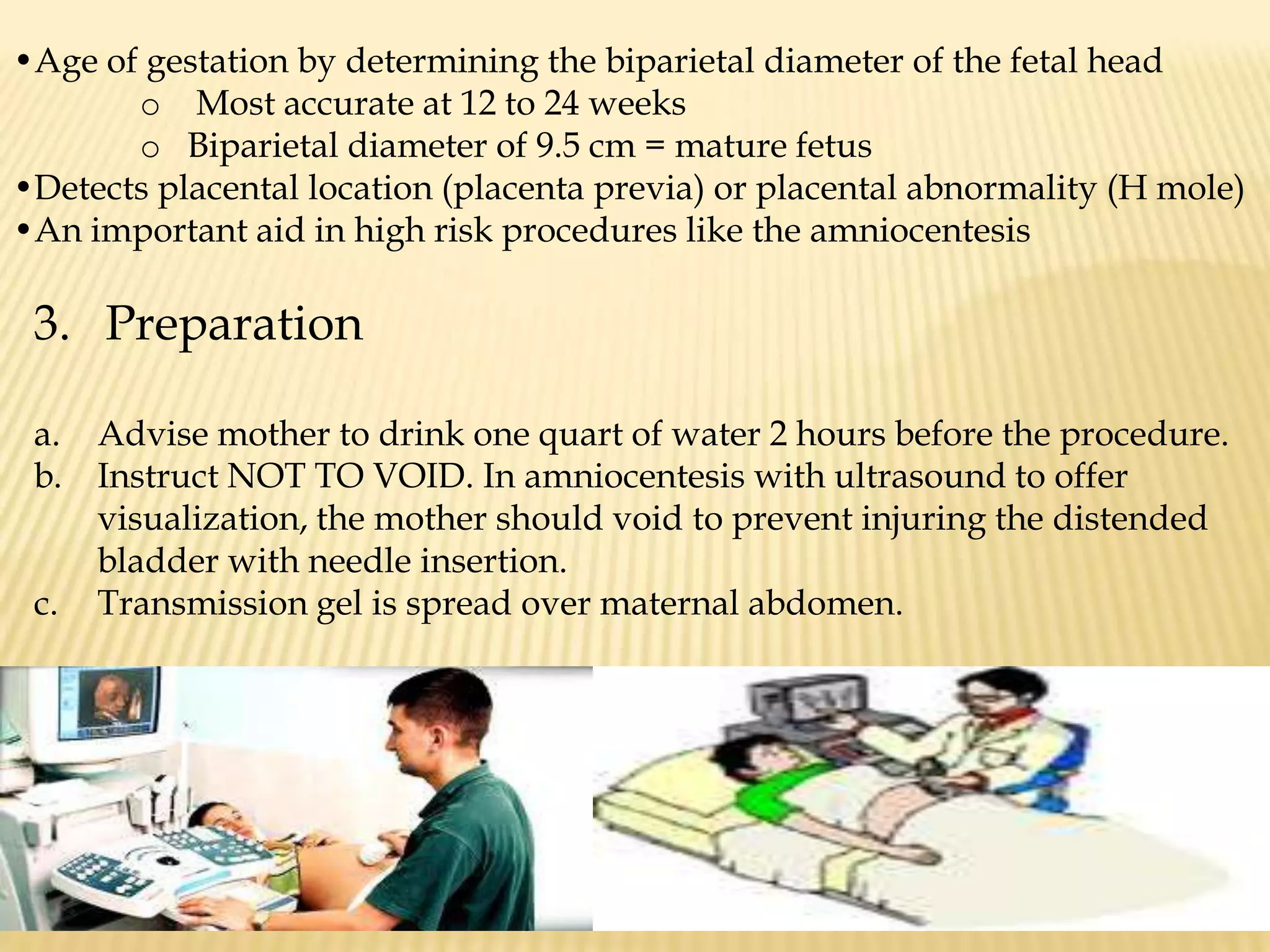 Number (multiple pregnancy)