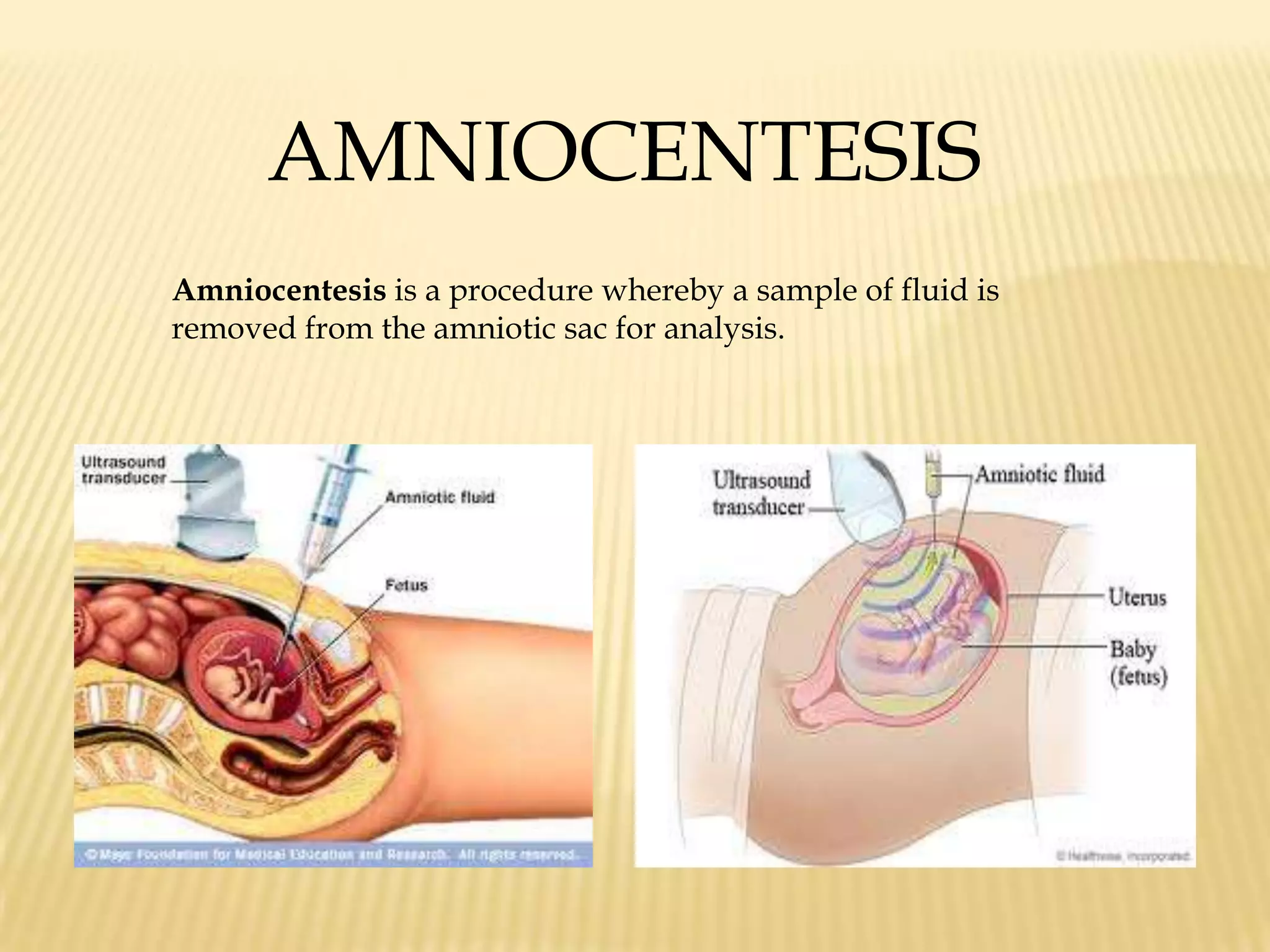     Most accurate at 12 to 24 weeks