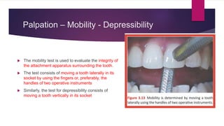 Palpation – Mobility - Depressibility
 The mobility test is used to evaluate the integrity of
the attachment apparatus surrounding the tooth.
 The test consists of moving a tooth laterally in its
socket by using the fingers or, preferably, the
handles of two operative instruments
 Similarly, the test for depressibility consists of
moving a tooth vertically in its socket
 
