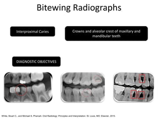 Diagnostic Aids in Endodontics | PPTX