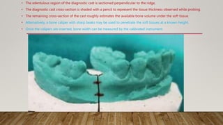 Diagnostic aids in implant seminar in detail | PPTX