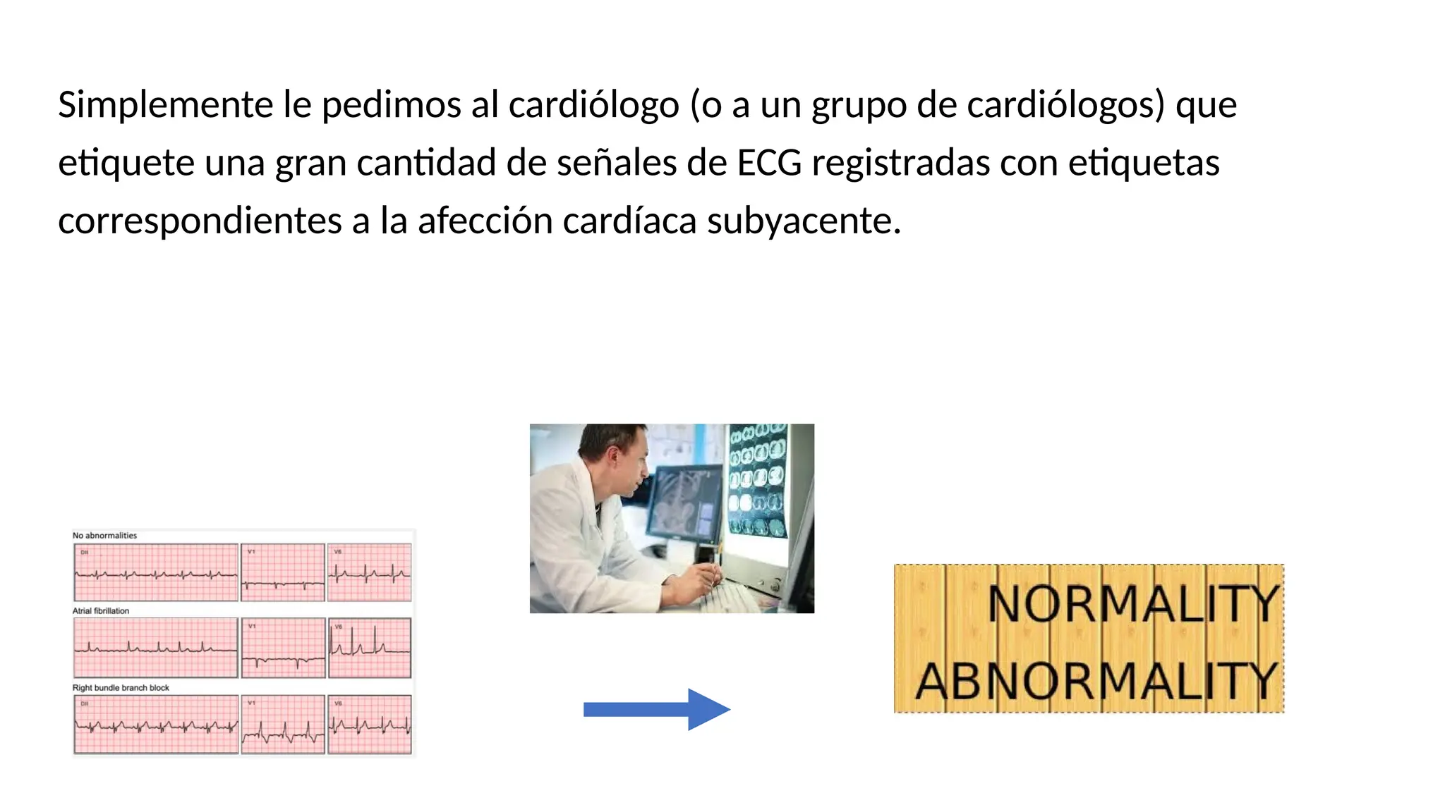 Simplemente le pedimos al cardiólogo (o a un grupo de cardiólogos) que
etiquete una gran cantidad de señales de ECG registradas con etiquetas
correspondientes a la afección cardíaca subyacente.
 