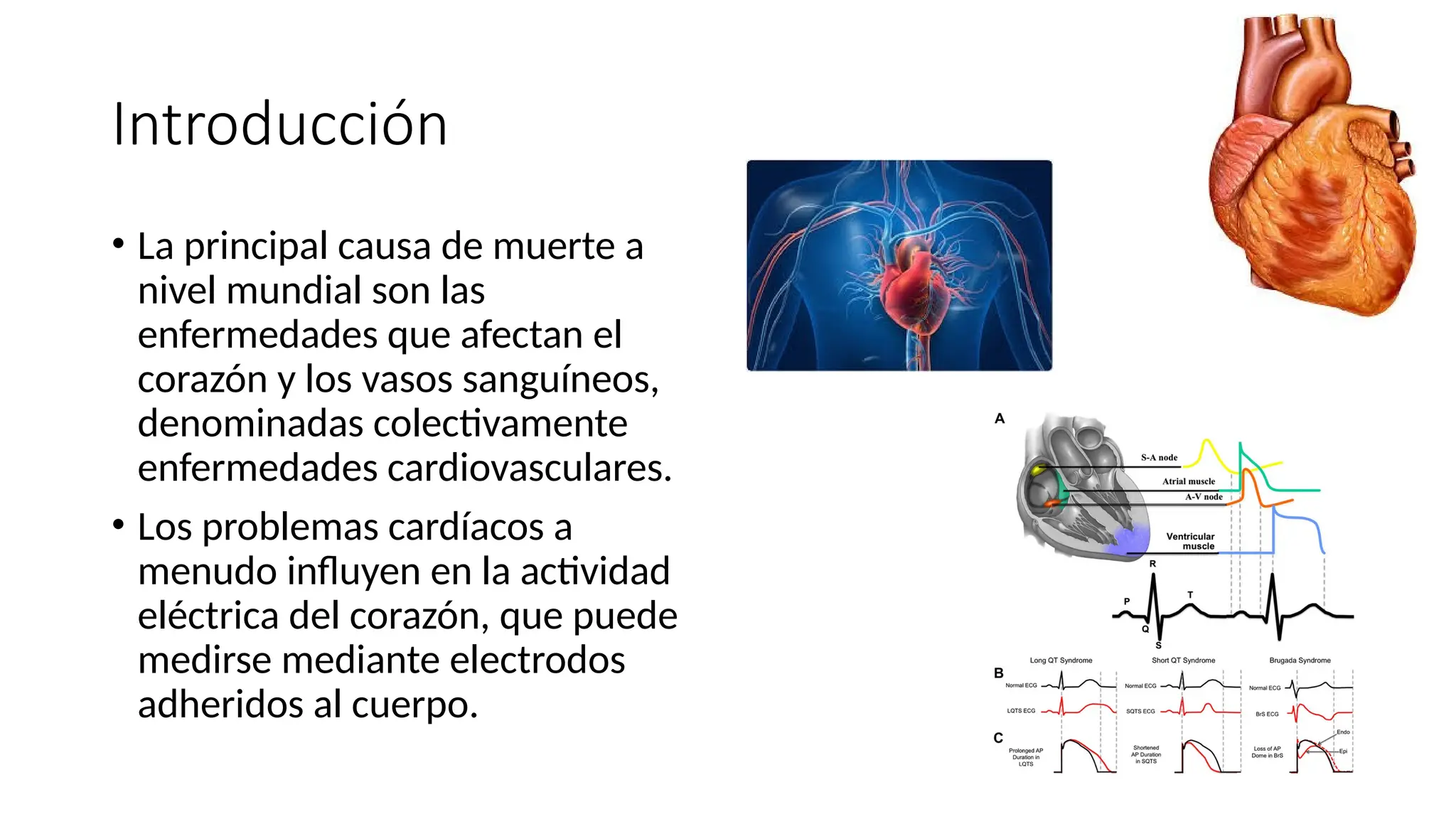 Introducción
• La principal causa de muerte a
nivel mundial son las
enfermedades que afectan el
corazón y los vasos sanguíneos,
denominadas colectivamente
enfermedades cardiovasculares.
• Los problemas cardíacos a
menudo influyen en la actividad
eléctrica del corazón, que puede
medirse mediante electrodos
adheridos al cuerpo.
 