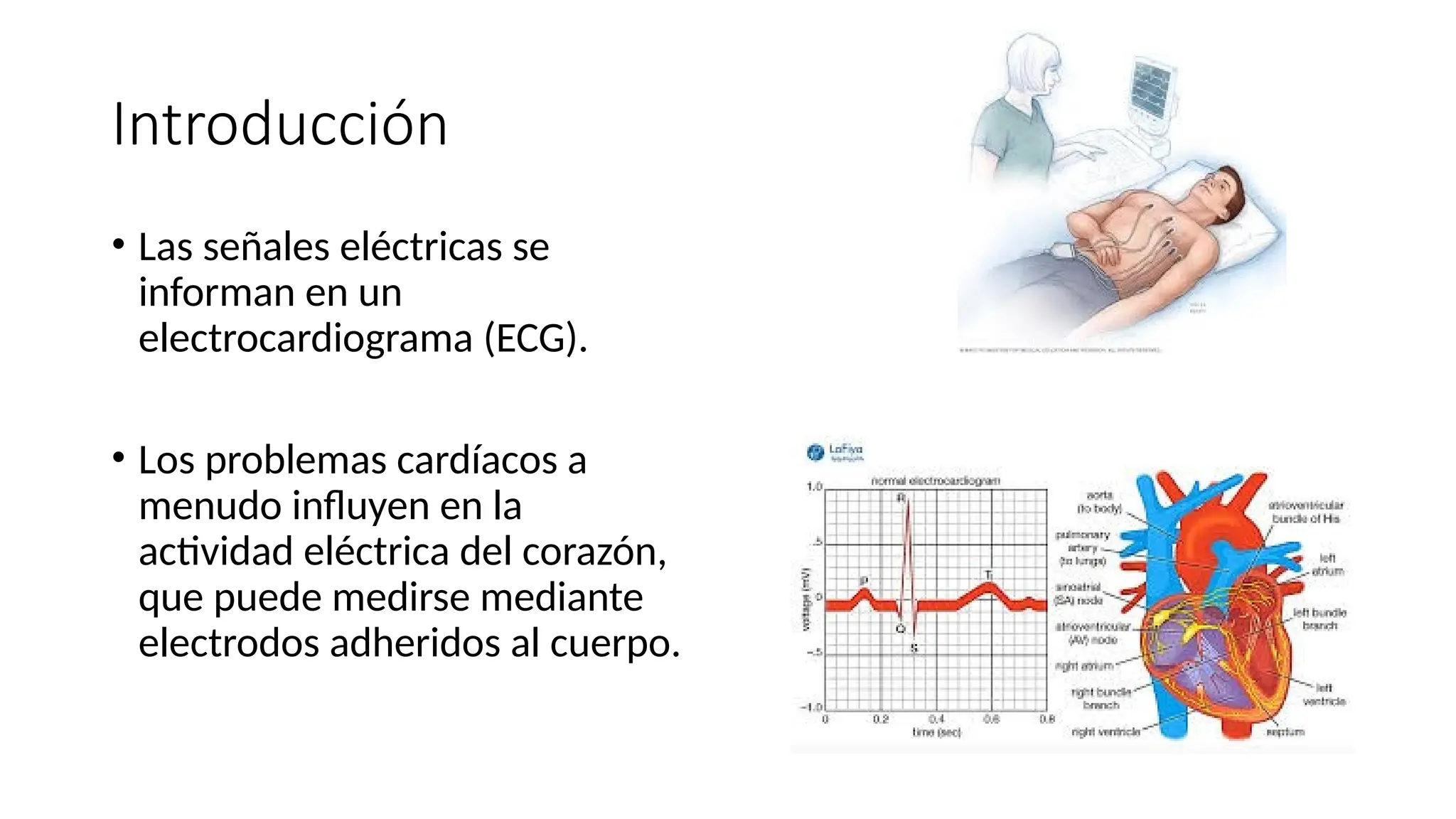 Introducción
• Las señales eléctricas se
informan en un
electrocardiograma (ECG).
• Los problemas cardíacos a
menudo influyen en la
actividad eléctrica del corazón,
que puede medirse mediante
electrodos adheridos al cuerpo.
 