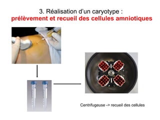 3. Réalisation d’un caryotype :  prélèvement et recueil des cellules amniotiques Centrifugeuse -> recueil des cellules 