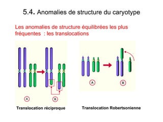 5.4 .  Anomalies de structure du caryotype Les anomalies de structure équilibrées les plus fréquentes  : les translocations Translocation réciproque Translocation Robertsonienne 